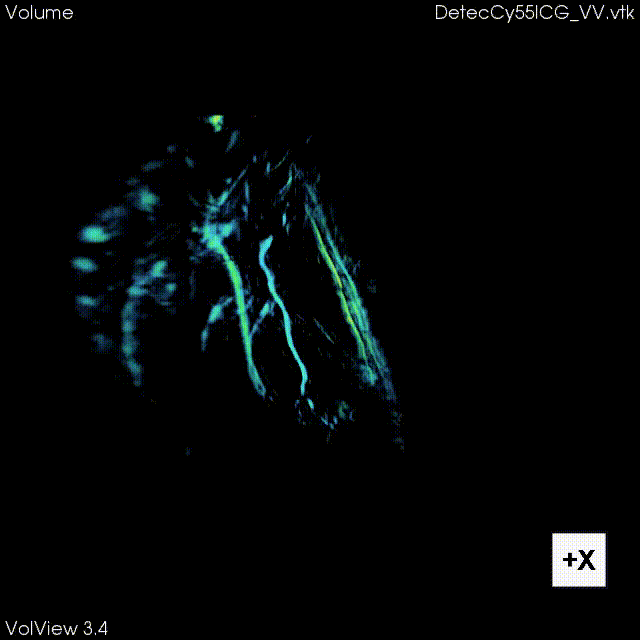 Transcranial quantitative ultrasound tomography and image-guided brain therapy